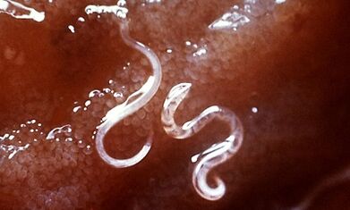 What parasites are in the liver in humans