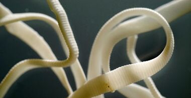 Straight parasite from the human body